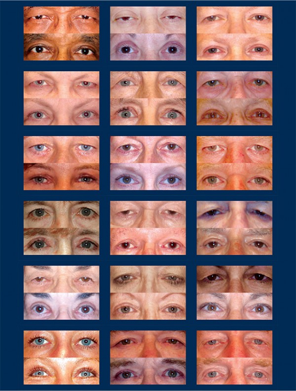 Oculoplastic Center Costello Eye Physicians & Surgeons